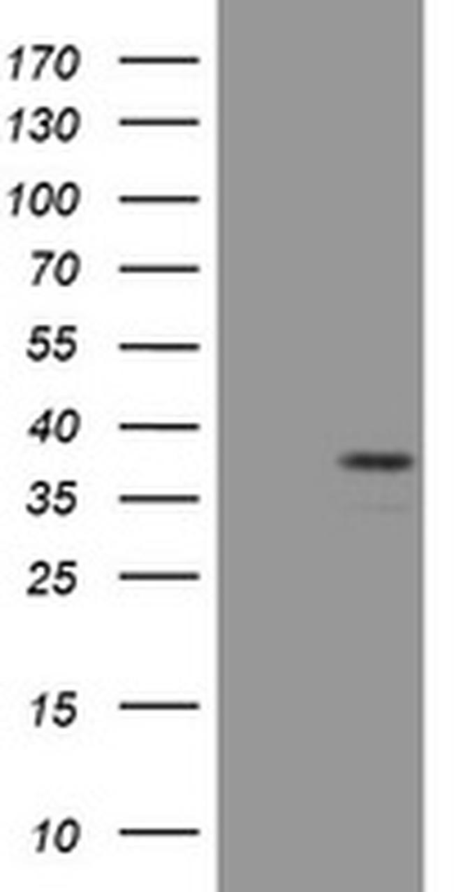 PAX4 Antibody in Western Blot (WB)