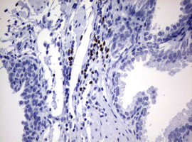 PAX5 Antibody in Immunohistochemistry (Paraffin) (IHC (P))