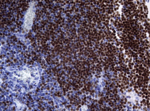 PAX5 Antibody in Immunohistochemistry (Paraffin) (IHC (P))