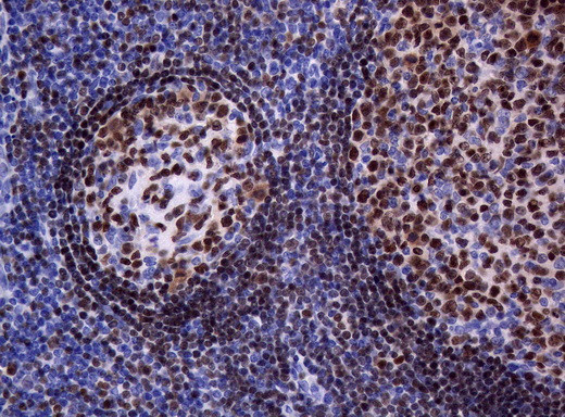 PAX5 Antibody in Immunohistochemistry (Paraffin) (IHC (P))