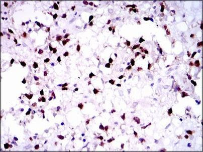 PAX5 Antibody in Immunohistochemistry (Paraffin) (IHC (P))