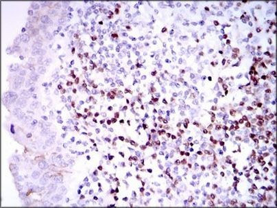 PAX5 Antibody in Immunohistochemistry (Paraffin) (IHC (P))