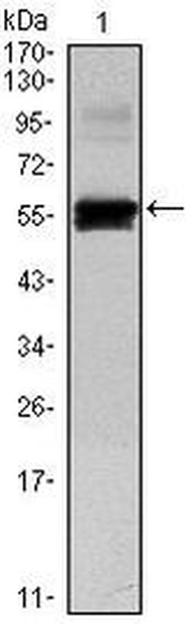 PAX6 Antibody in Western Blot (WB)