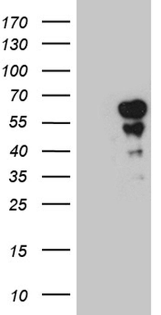 PAX7 Antibody in Western Blot (WB)