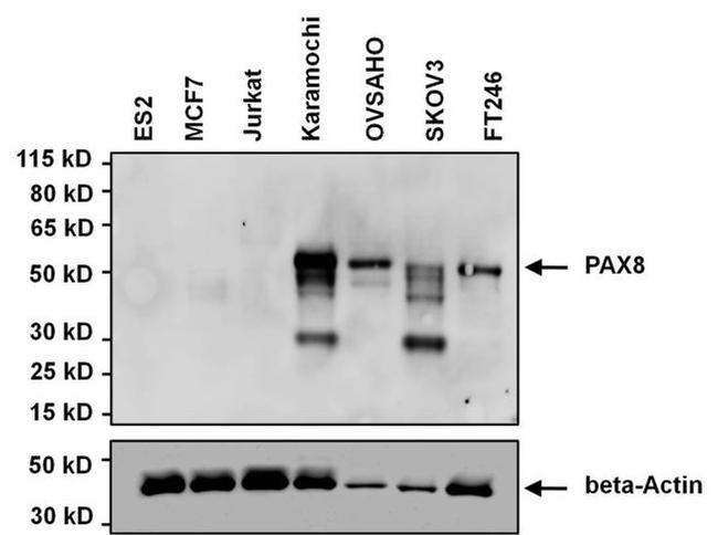 PAX8 Antibody in Western Blot (WB)