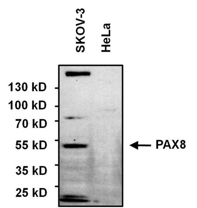 PAX8 Antibody in Western Blot (WB)