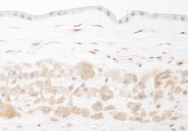 NAMPT/PBEF/Visfatin Antibody in Immunohistochemistry (IHC)