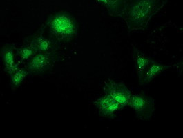 PBLD Antibody in Immunocytochemistry (ICC/IF)