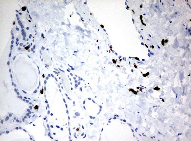 PBX1 Antibody in Immunohistochemistry (Paraffin) (IHC (P))