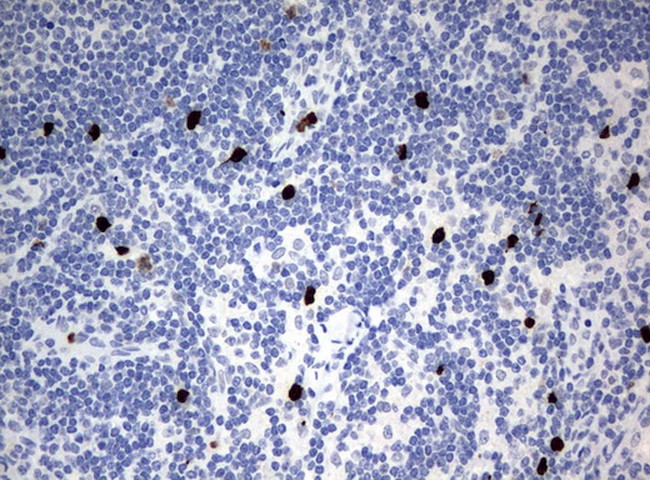 PBX1 Antibody in Immunohistochemistry (Paraffin) (IHC (P))