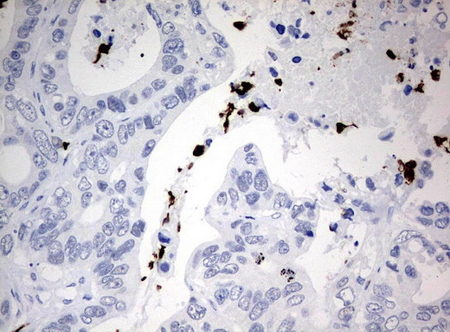 PBX1 Antibody in Immunohistochemistry (Paraffin) (IHC (P))