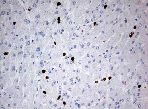 PBX1 Antibody in Immunohistochemistry (Paraffin) (IHC (P))