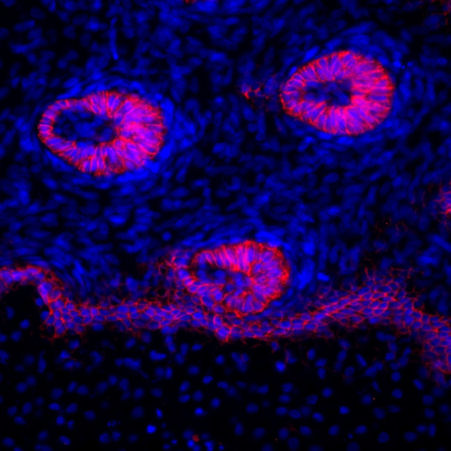 P-cadherin Antibody in Immunohistochemistry (Frozen) (IHC (F))