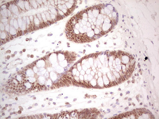 PCBP1 Antibody in Immunohistochemistry (Paraffin) (IHC (P))