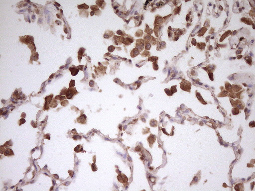 PCBP1 Antibody in Immunohistochemistry (Paraffin) (IHC (P))