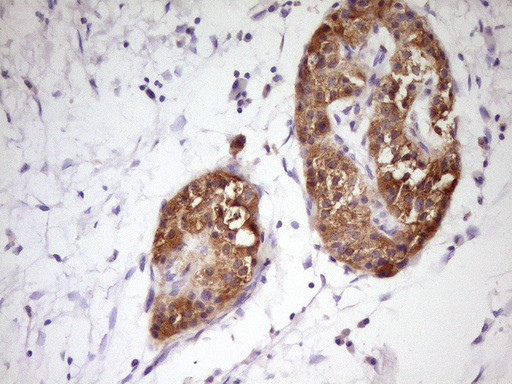 PCBP1 Antibody in Immunohistochemistry (Paraffin) (IHC (P))