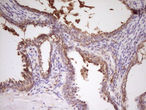 PCBP1 Antibody in Immunohistochemistry (Paraffin) (IHC (P))