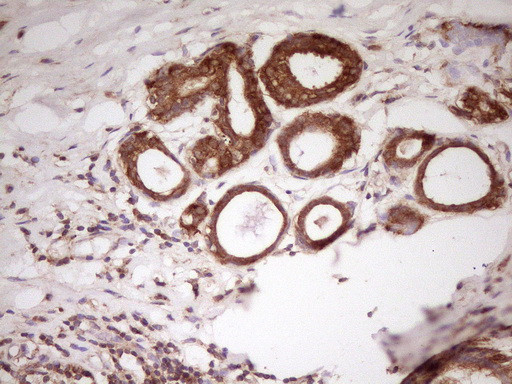 PCBP1 Antibody in Immunohistochemistry (Paraffin) (IHC (P))