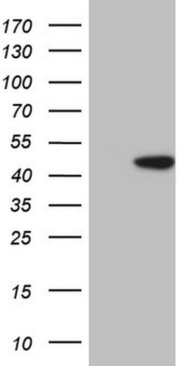 PCBP1 Antibody in Western Blot (WB)