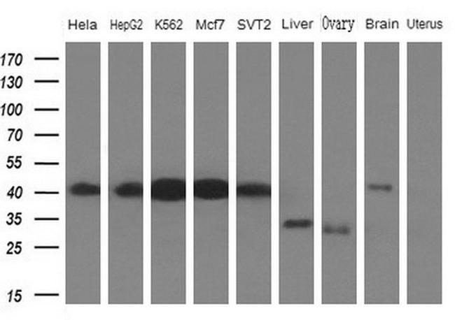 PCBP1 Antibody in Western Blot (WB)