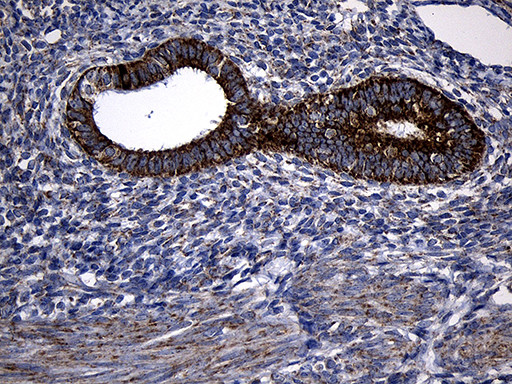 PCCA Antibody in Immunohistochemistry (Paraffin) (IHC (P))