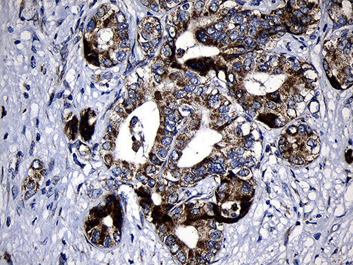 PCCA Antibody in Immunohistochemistry (Paraffin) (IHC (P))