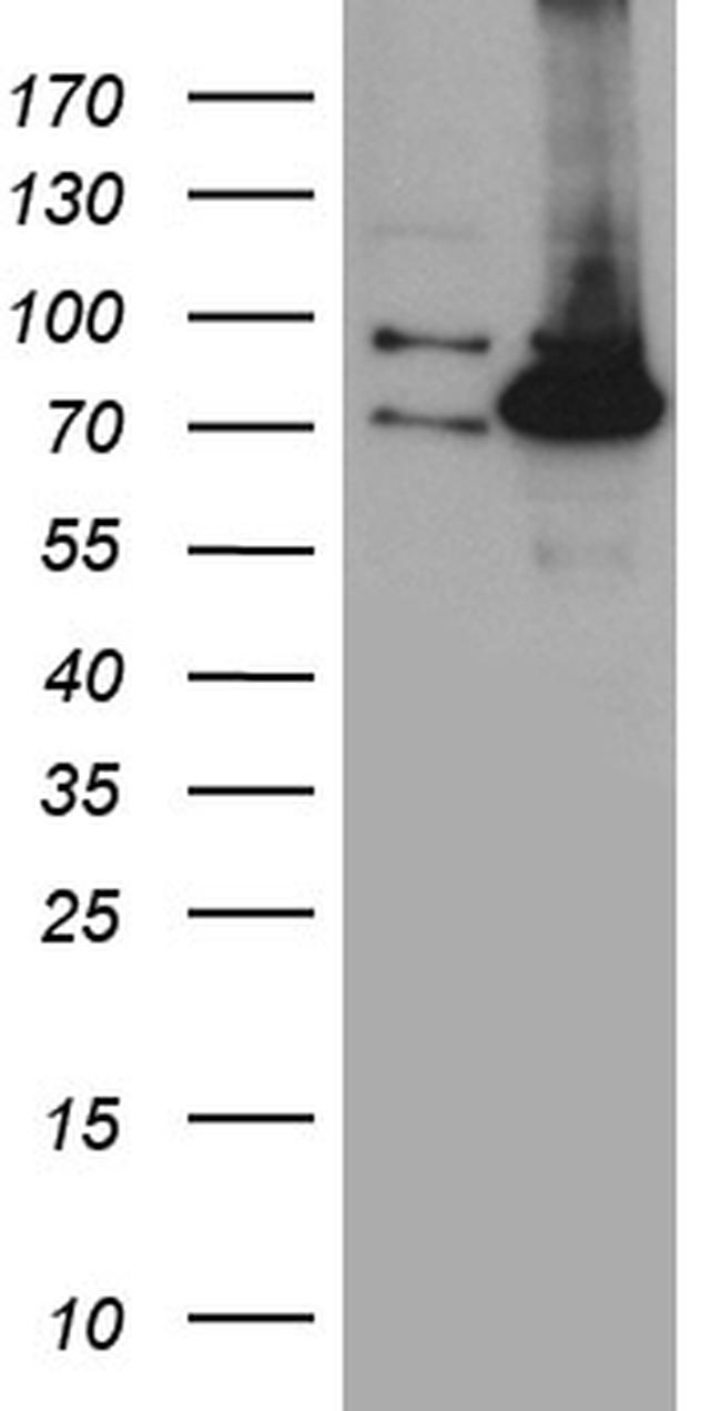 PCCA Antibody in Western Blot (WB)