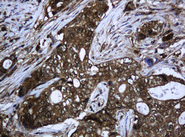 PCDH7 Antibody in Immunohistochemistry (Paraffin) (IHC (P))