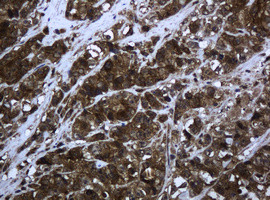 PCDH7 Antibody in Immunohistochemistry (Paraffin) (IHC (P))