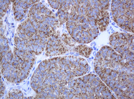 PCDH7 Antibody in Immunohistochemistry (Paraffin) (IHC (P))