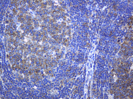 PCDH7 Antibody in Immunohistochemistry (Paraffin) (IHC (P))