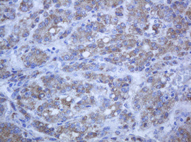 PCDH7 Antibody in Immunohistochemistry (Paraffin) (IHC (P))