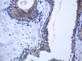 PCDH7 Antibody in Immunohistochemistry (Paraffin) (IHC (P))