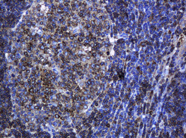 PCDH7 Antibody in Immunohistochemistry (Paraffin) (IHC (P))