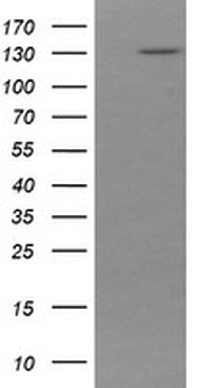 PCDH7 Antibody in Western Blot (WB)