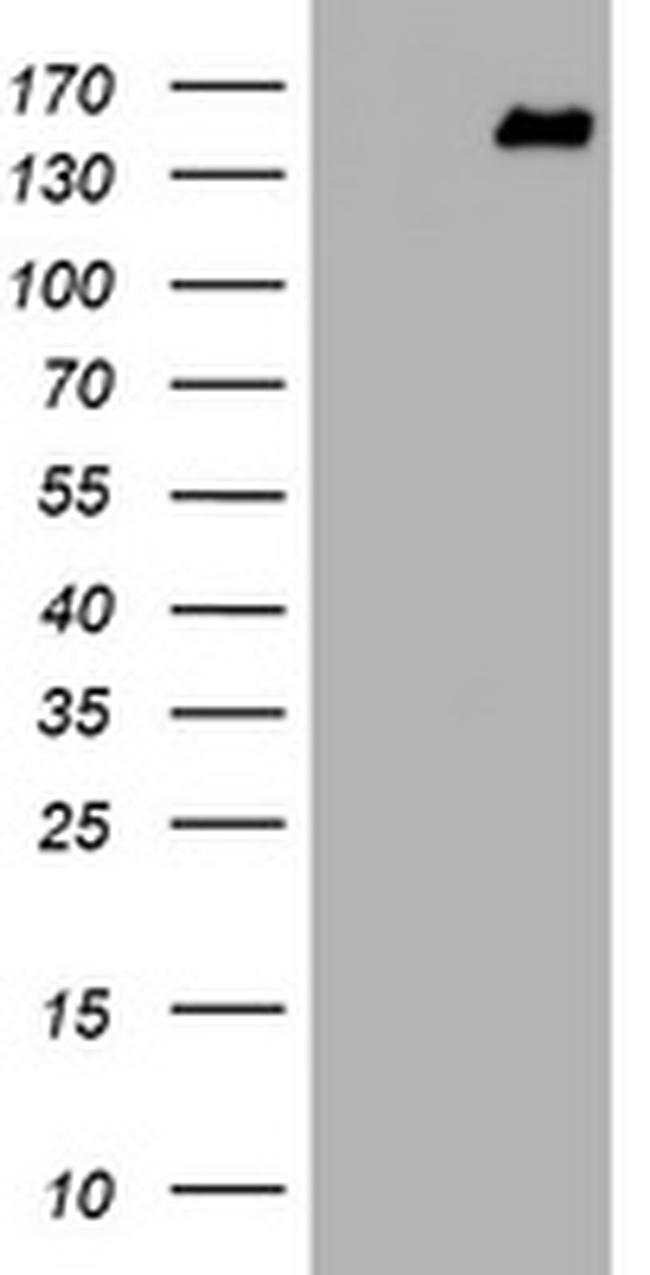 PCDH7 Antibody in Western Blot (WB)