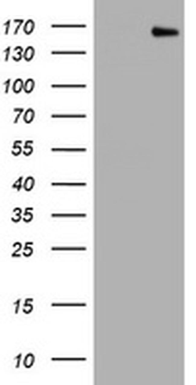 PCDH7 Antibody in Western Blot (WB)