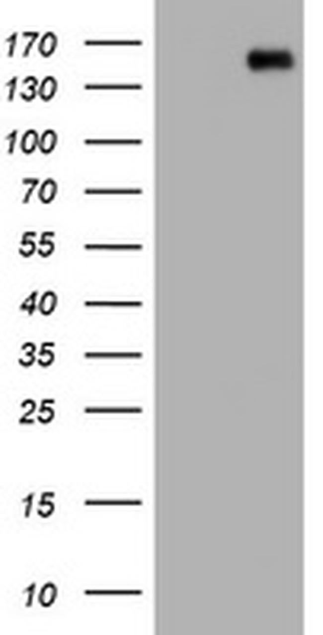 PCDH7 Antibody in Western Blot (WB)