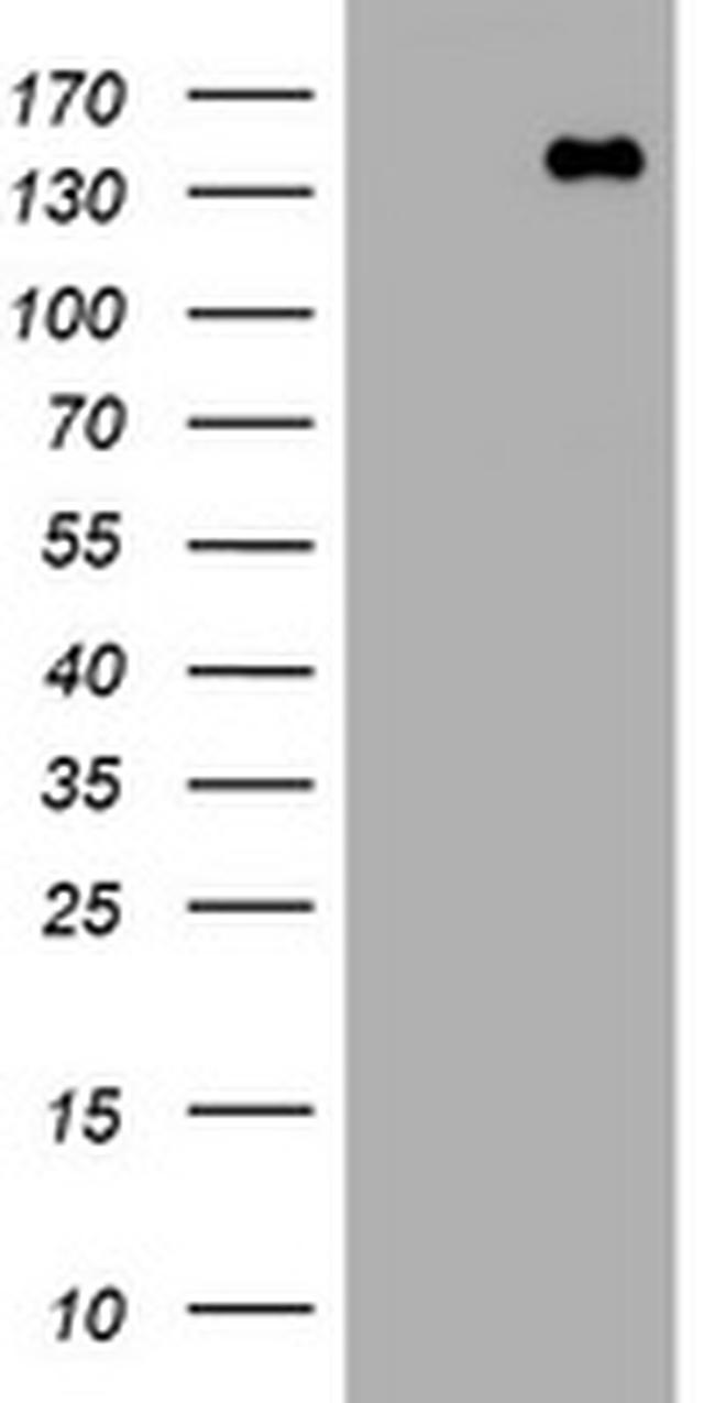 PCDH7 Antibody in Western Blot (WB)