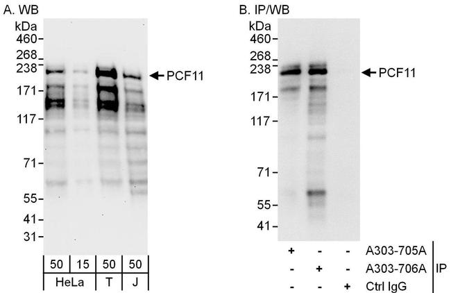 PCF11 Antibody in Western Blot (WB)