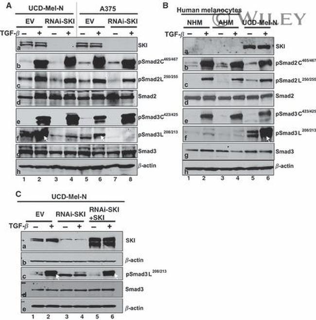 SMAD3 Antibody in Western Blot (WB)