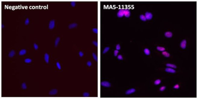 PCNA Antibody in Immunocytochemistry (ICC/IF)