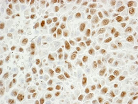 PCNA Antibody in Immunohistochemistry (IHC)