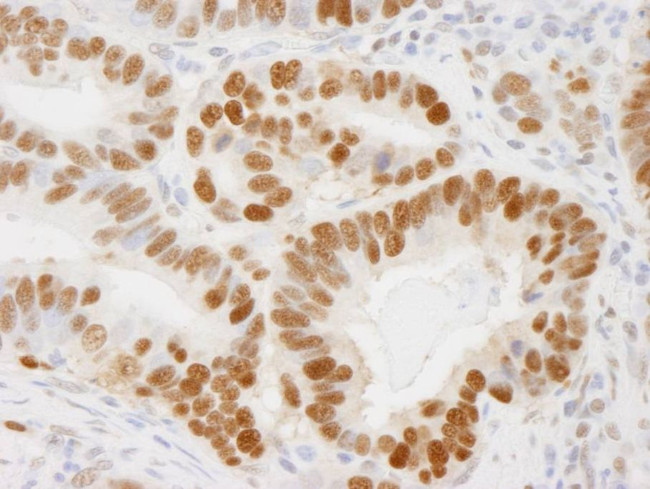 PCNA Antibody in Immunohistochemistry (IHC)