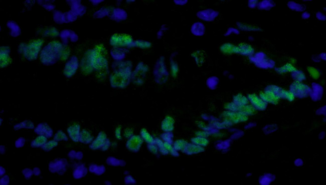 PCNA Antibody in Immunohistochemistry (IHC)