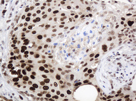 PCNA Antibody in Immunohistochemistry (Paraffin) (IHC (P))