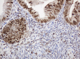 PCNA Antibody in Immunohistochemistry (Paraffin) (IHC (P))