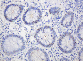 PCNA Antibody in Immunohistochemistry (Paraffin) (IHC (P))