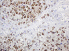 PCNA Antibody in Immunohistochemistry (Paraffin) (IHC (P))