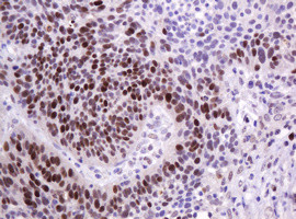 PCNA Antibody in Immunohistochemistry (Paraffin) (IHC (P))